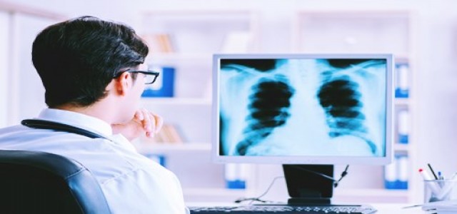 UK university uses graphene to develop lung cancer detection device